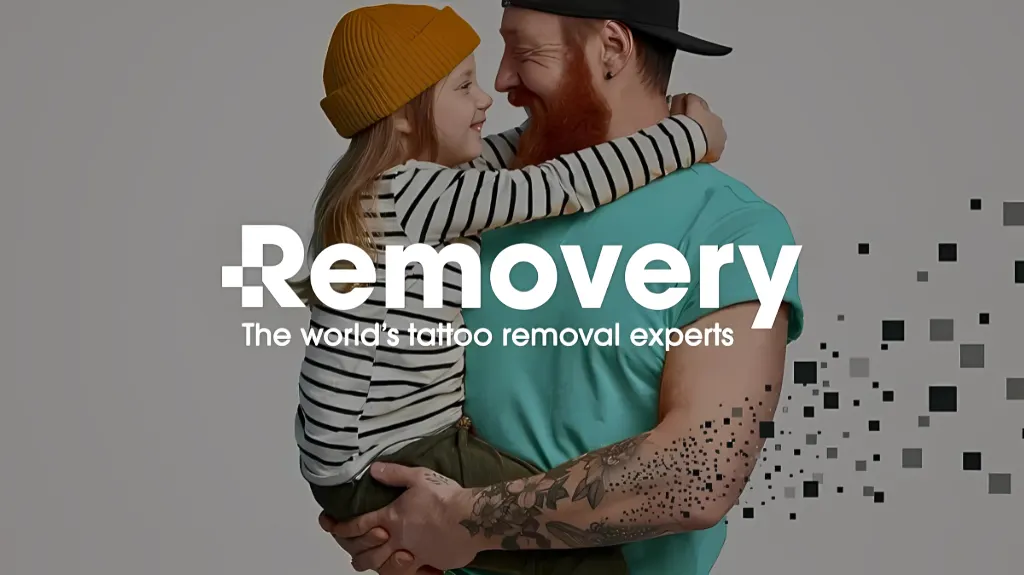 Removery Tattoo Removal & Fading — Tattoo removal service in Albany